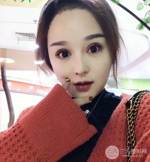 种发际线果图