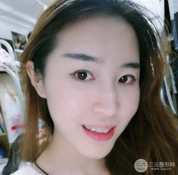 门牙矫正