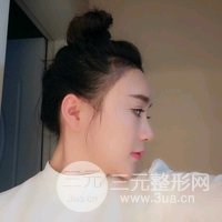 植发手术果