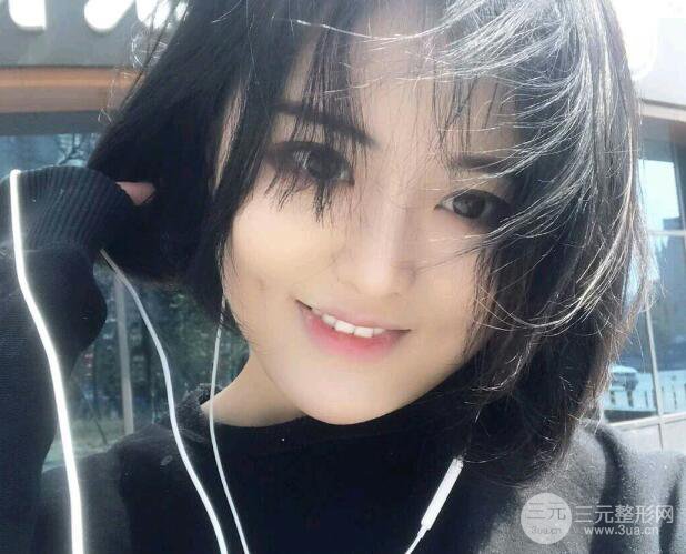 重庆华美酒窝整形价格