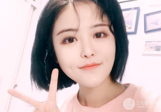 重庆华美酒窝整形价格