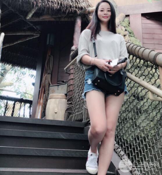 大腿环形吸脂