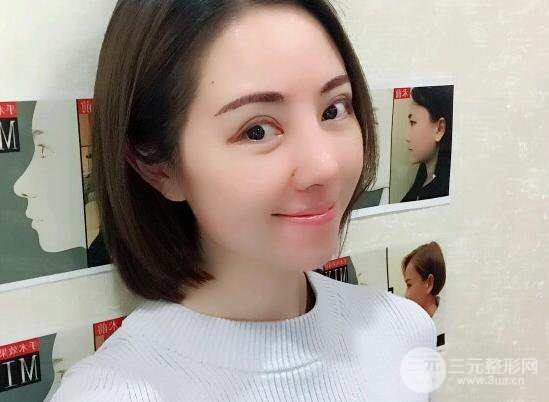北京膨体隆鼻