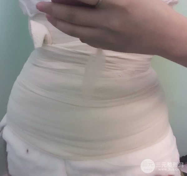 水动力吸脂术