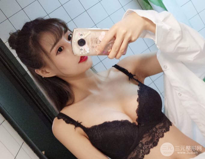 隆胸术后案例展示