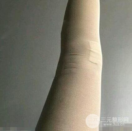 光纤溶脂瘦大腿