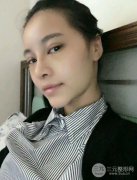 广州华美双眼皮全切过程大分享 变女神就是这么简单！