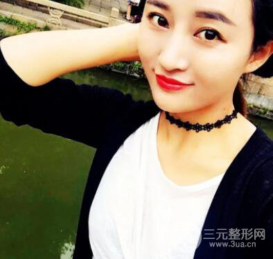 自体脂肪填充额头