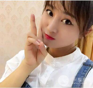 自体脂肪填充额头