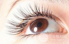 成都做睫毛种植多少钱？影响价格的因素有哪些？