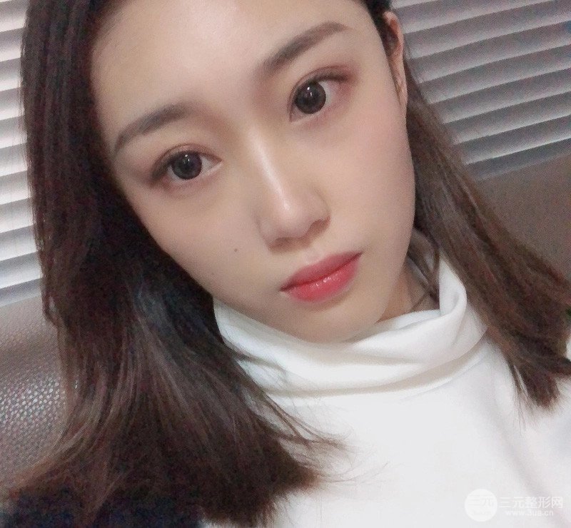 自体脂肪面部填充