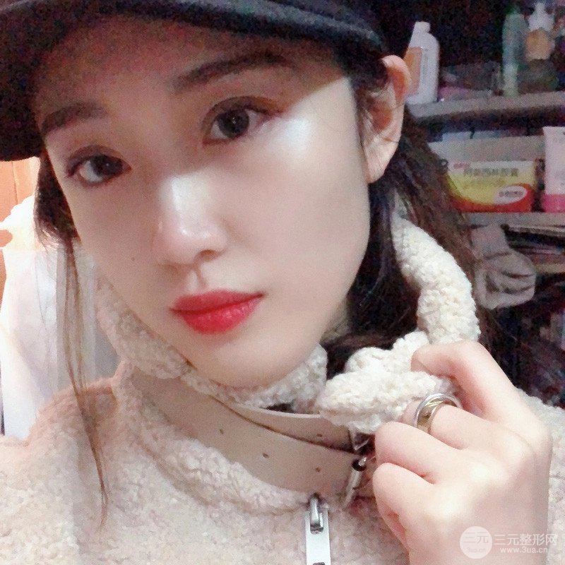 自体脂肪面部填充