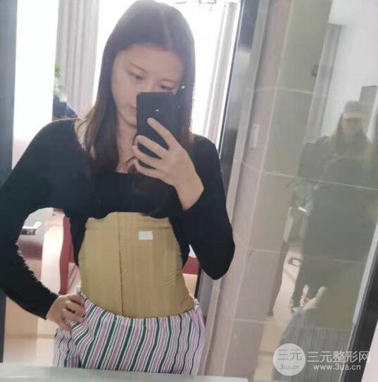 腰腹吸脂