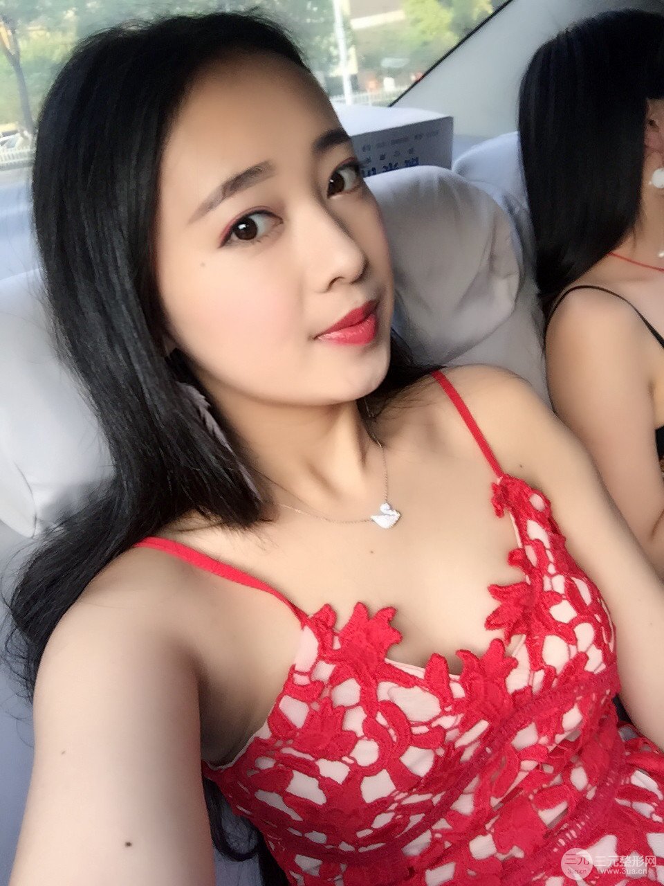 北京八大处李发成做完详细部吸脂