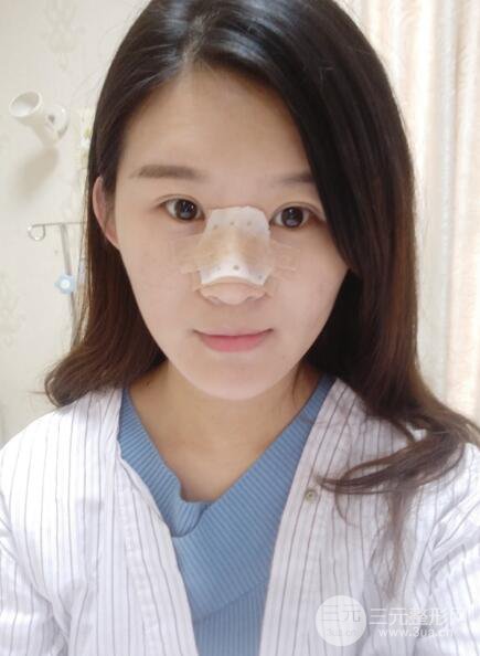 上海伊莱美医疗美容医院立秀膨体隆鼻果
