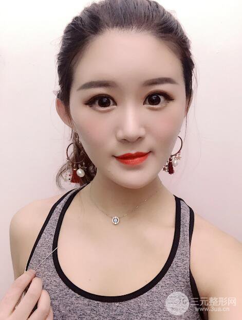 上海伊莱美医疗美容医院立秀膨体隆鼻果