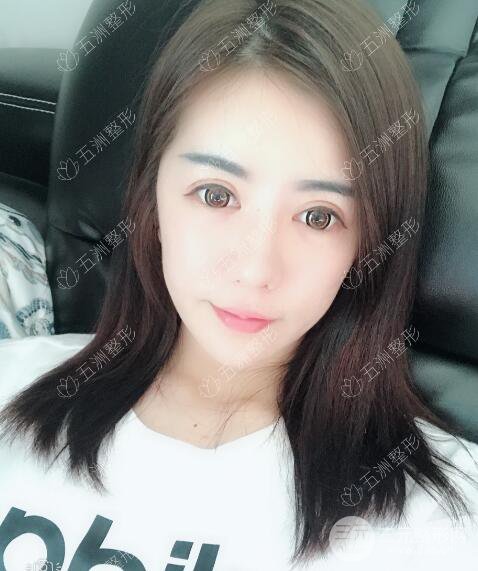重庆五洲整形美容魏恒隆鼻整形