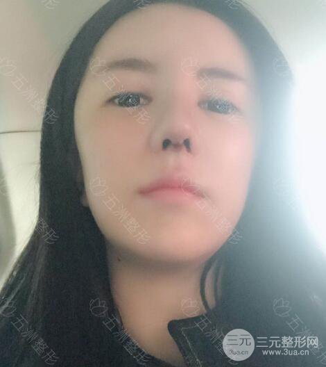 重庆五洲整形美容魏恒隆鼻整形