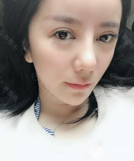 重庆五洲整形美容魏恒隆鼻整形