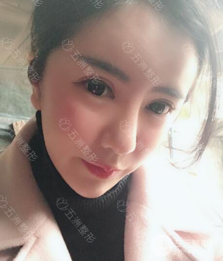 重庆五洲整形美容魏恒隆鼻整形