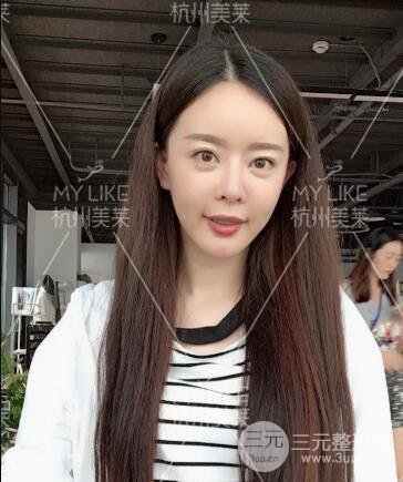 杭州美莱发际线种植