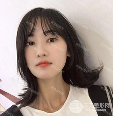 双眼皮