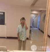 上海九院大腿吸脂减肥果杠杠的 附真实真人果图案例赏析