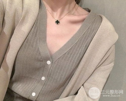 【隆胸案例展示】