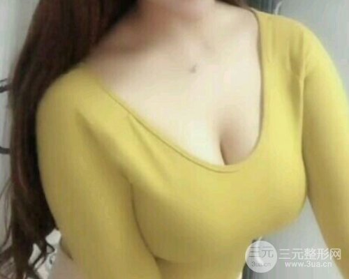 【隆胸案例展示】