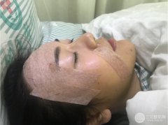自体脂肪丰胸果自然吗及自体脂肪丰胸要多少钱 自体脂肪丰胸果自然吗及自体脂肪丰胸要多少钱