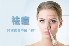 复合彩光祛痘多少钱?成好吗