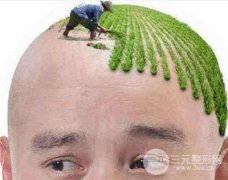 植发怎么样?果*吗? 植发怎么样?果*吗?