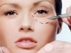 去眼袋失败修复手术怎么做？