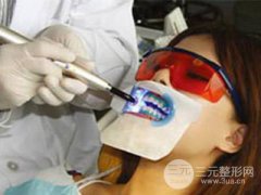 冷光美白牙齿需要多少钱