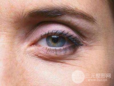 去鱼尾纹的技术有哪些 快速去鱼尾纹的方法