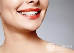 关于烤瓷牙的种类有哪些