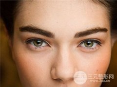 北京开内眼角需要多少钱