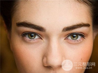 北京开内眼角需要多少钱