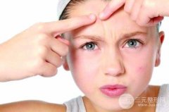 复合彩光去痘会反弹吗