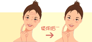 玻尿酸去除鱼尾纹果怎么样