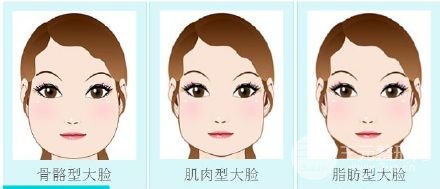 瘦脸方式大盘点