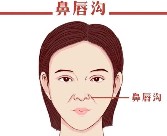 鼻唇沟填充
