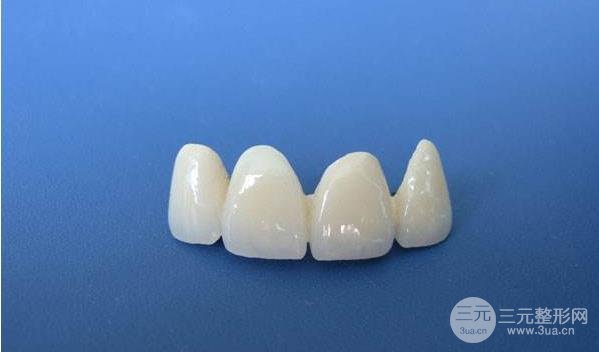 三甲医院做镍铬烤瓷牙多少钱?