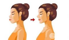 儿童骨性龅牙是什么样子？儿童骨性龅牙严重吗？