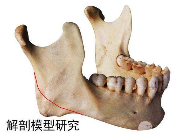 下颌角整容