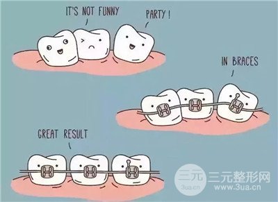 成年人还可以做牙齿矫正吗?牙齿矫正有年龄限制吗?