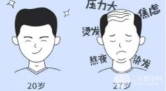 植发后用什么发型,有发际线就是可以为所欲为~ 植发后用什么发型,有发际线就是可以为所欲为~