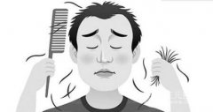 青年男性脱发怎么办?缓解脱发方法都有哪些呢? 青年男性脱发怎么办?缓解脱发方法都有哪些呢?