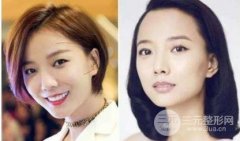 发际线会越刮越密,新长出的头发发质会变好是真的吗? 发际线会越刮越密,新长出的头发发质会变好是真的吗?