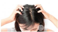 毛囊炎会脱发?怎么才能避免头发毛囊炎? 毛囊炎会脱发?怎么才能避免头发毛囊炎?